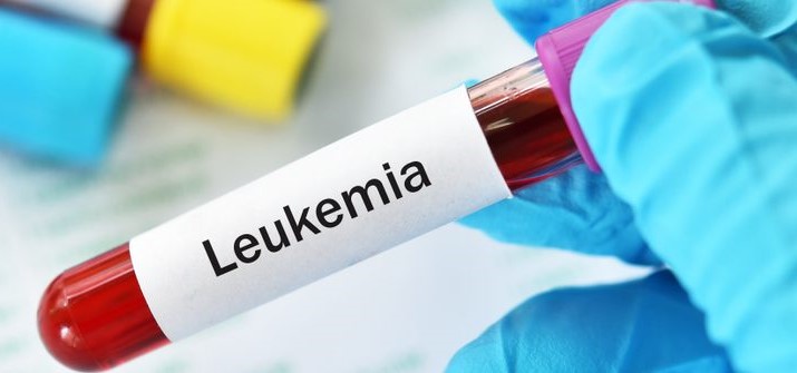 Leucemia e1661765906412